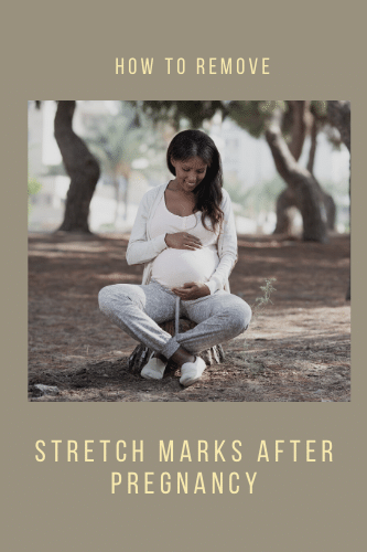 How To Remove Stretch Marks After Pregnancy Home Remedies Medical Treatments